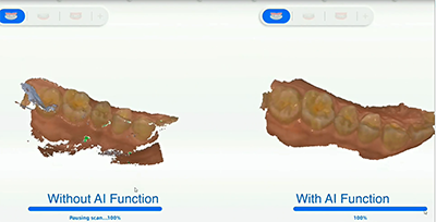 XL013 Dental Aoralscan 3